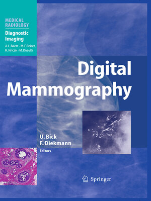 cover image of Digital Mammography